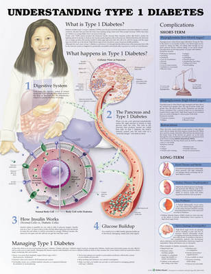 Understanding Type 1 Diabetes Anatomical Chart -  Anatomical Chart Company, Jeff Unger