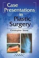 Case Presentations in Plastic Surgery - Christopher Stone