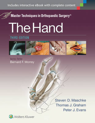 Master Techniques in Orthopaedic Surgery: The Hand -  Peter Evans,  Thomas J. Graham,  Steven Maschke