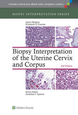 Biopsy Interpretation of the Uterine Cervix and Corpus -  Elizabeth D. Euscher,  Anais Malpica