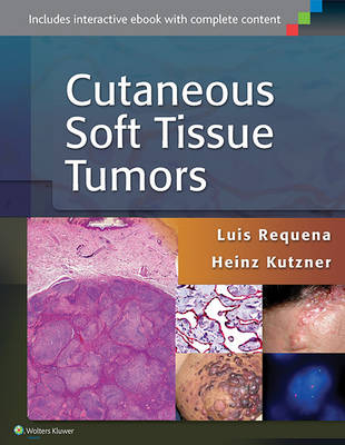 Cutaneous Soft Tissue Tumors -  Heinz Kutzner,  Luis Requena