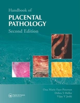 Handbook of Placental Pathology - Ona Marie Faye-Petersen, Debra S. Heller, Vijay V. Joshi