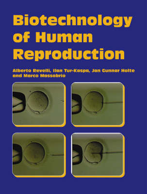 Biotechnology of Human Reproduction - 