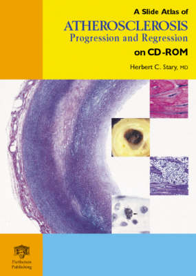 A Slide Atlas of Atherosclerosis Progression and Regression - Herbert C. Stary