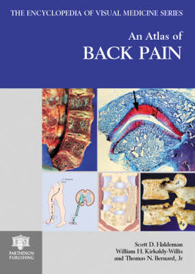 An Atlas of Back Pain - Scott D. Haldeman, William H. Kirkaldy-Willis, Thomas N. Bernard