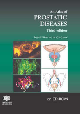An Atlas of Prostatic Diseases CD-ROM - Roger S. Kirby