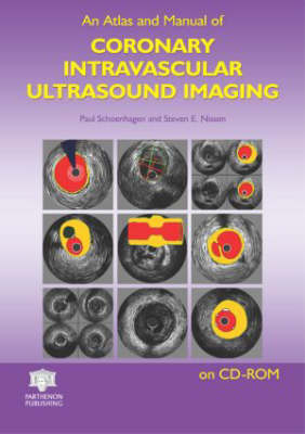 An Atlas and Manual of Coronary Intravascular Ultrasound Imaging - 