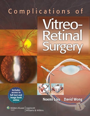 Complications of Vitreo-Retinal Surgery -  Noemi Lois,  David Wong