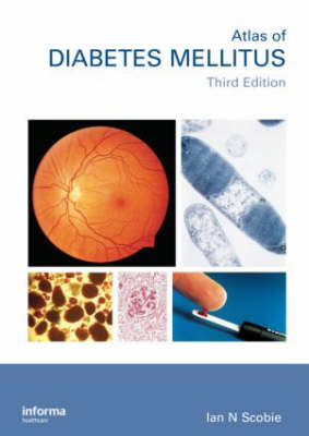 An Atlas of Diabetes Mellitus, Second Edition - Ian N. Scobie