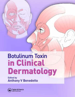 Botulinum Toxin in Clinical Dermatology - Anthony V. Benedetto