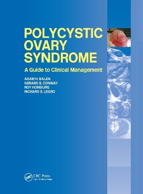 Polycystic Ovary Syndrome - 