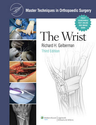 Master Techniques in Orthopaedic Surgery: The Wrist -  Richard H. Gelberman