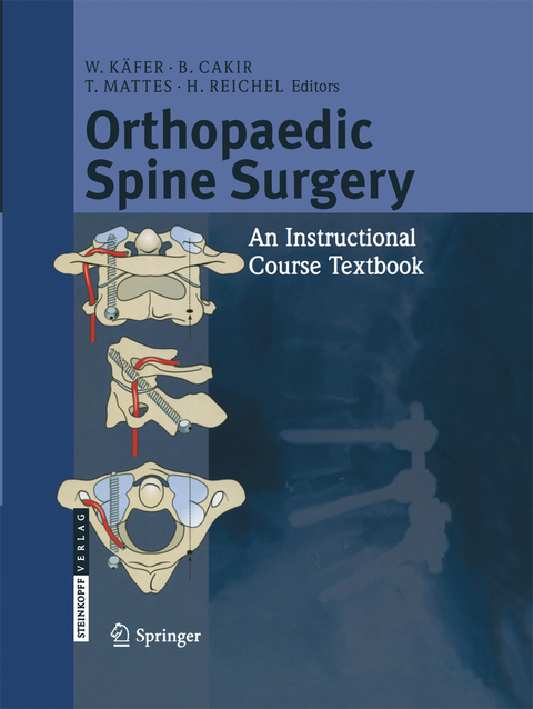 Orthopaedic Spine Surgery - 