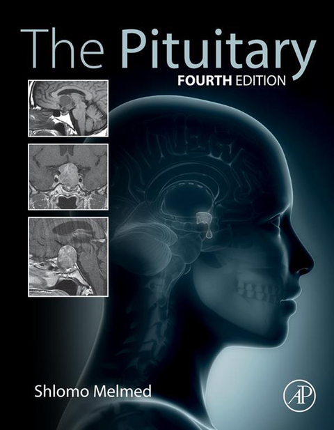 Pituitary - 