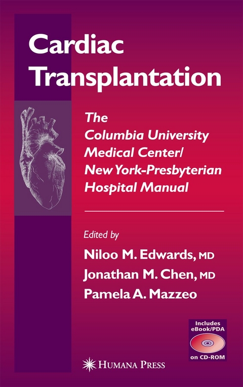 Cardiac Transplantation - Niloo M. Edwards, Jonathan M. Chen, Pamela A. Mazzeo