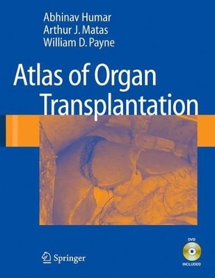 Atlas of Organ Transplantation - Abhinav Humar, Arthur J. Matas, William D. Payne