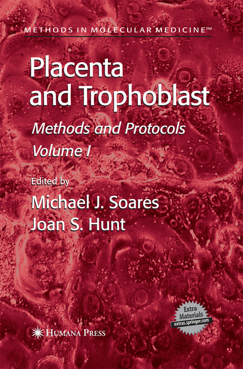 Placenta and Trophoblast - 