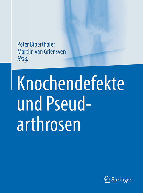 Knochendefekte und Pseudarthrosen -  Peter Biberthaler,  Martijn van Griensven,  Patrick Delhey