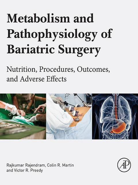 Metabolism and Pathophysiology of Bariatric Surgery - 