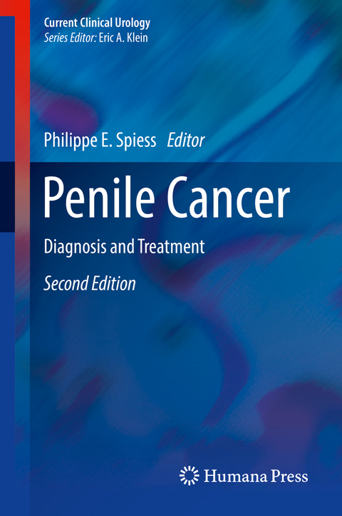 Penile Cancer - 