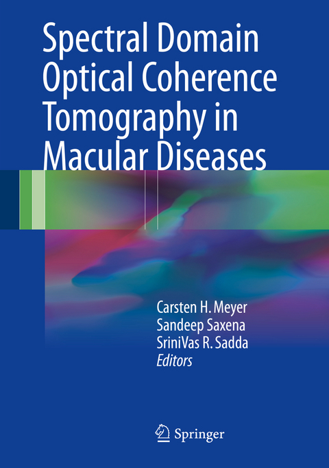 Spectral Domain Optical Coherence Tomography in Macular Diseases - 
