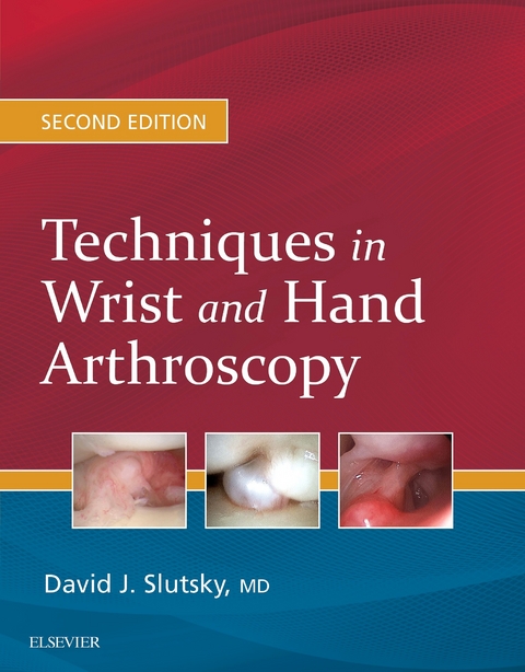 Techniques in Wrist and Hand Arthroscopy -  David J. Slutsky