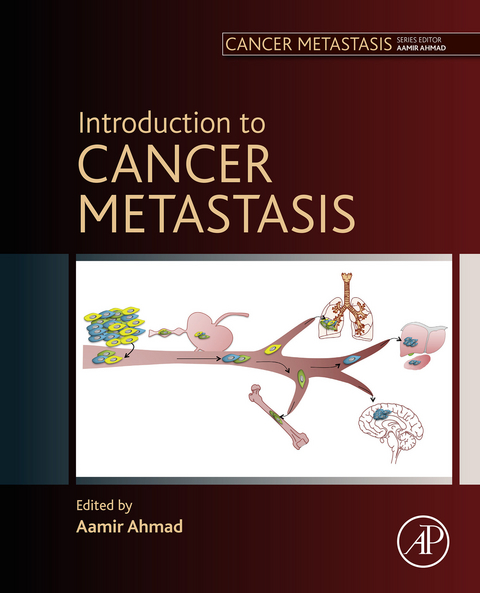 Introduction to Cancer Metastasis - 