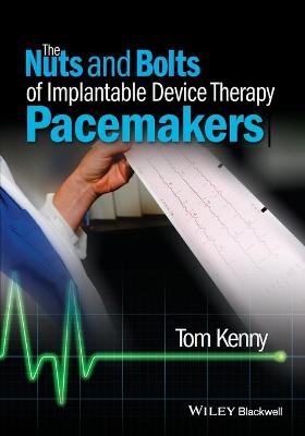 The Nuts and Bolts of Implantable Device Therapy - Tom Kenny