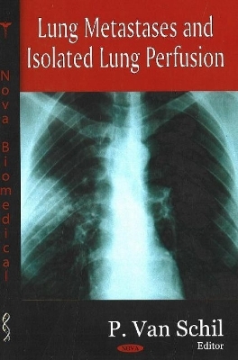 Lung Metastases & Isolated Lung Perfusion - 