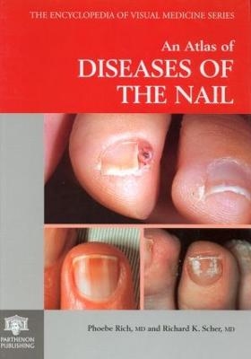 An Atlas of Diseases of the Nail - Phoebe Rich, Richard K. Scher