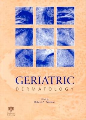 Geriatric Dermatology - 