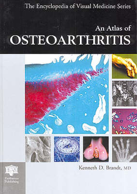 An Atlas of Osteoarthritis - K.D. Brandt