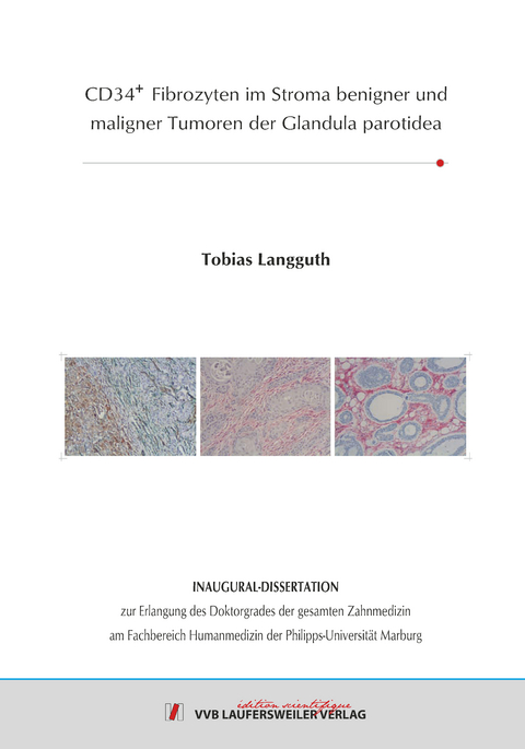 CD34+ Fibrozyten im Stroma benigner und maligner Tumoren der Glandula parotidea - Tobias Langguth