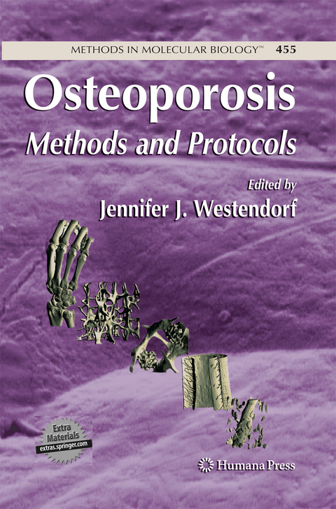 Osteoporosis - 