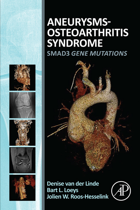 Aneurysms-Osteoarthritis Syndrome -  Denise van der Linde,  Bart L. Loeys,  Jolien Roos-Hesselink