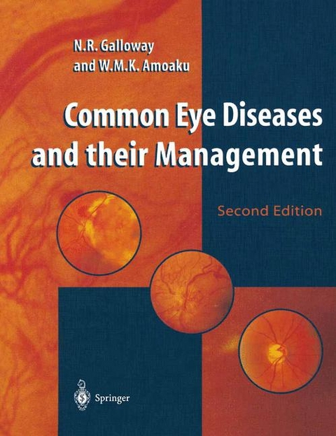 Common Eye Diseases and Their Management - N.R. Galloway, W.M.K. Amoaku, Peter H. Galloway, Andrew Browning