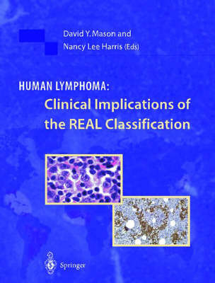 Human Lymphoma: Clinical Implications of the Real Classification - 