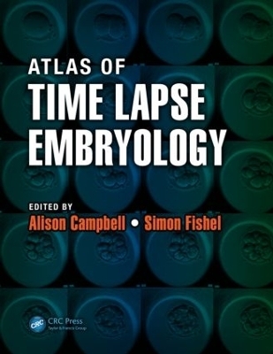 Atlas of Time Lapse Embryology - 