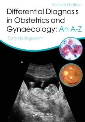 Differential Diagnosis in Obstetrics & Gynaecology - 