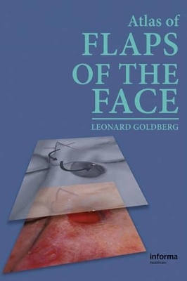Atlas of Flaps of the Face - Leonard H. Goldberg