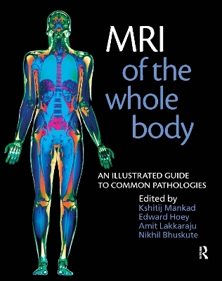MRI of the Whole Body - Nikhil Bhuskute, Edward Hoey, Amit Lakkaraju, Kshitij Mankad