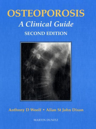 Osteoporosis - Anthony D. Woolf, Allan St J. Dixon, Richard Eastell