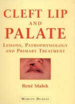 Cleft Lip and Palate - René Malek