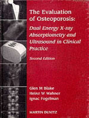Evaluation Of Osteoporosis - 