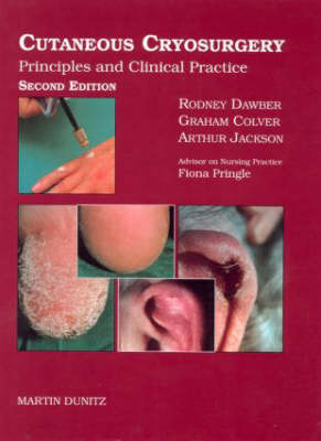 Cutaneous Cryosurgery - Fiona Pringle, Graham B. Colver