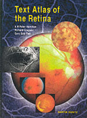 Text Atlas of the Retina - Gary Edd Fish, Richard Gregson, A M Peter Hamilton