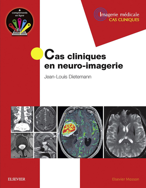 Cas cliniques en neuro-imagerie - 