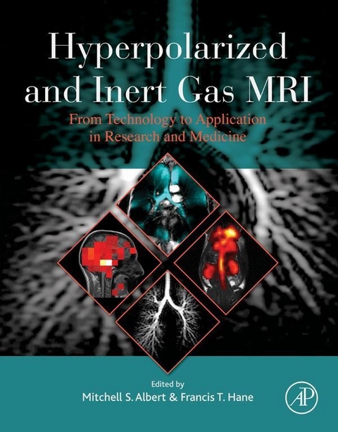 Hyperpolarized and Inert Gas MRI - 