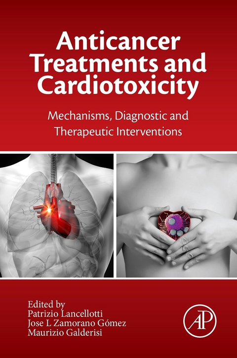 Anticancer Treatments and Cardiotoxicity - 