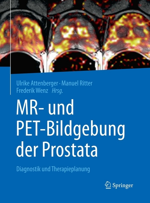 MR- und PET-Bildgebung der Prostata - 